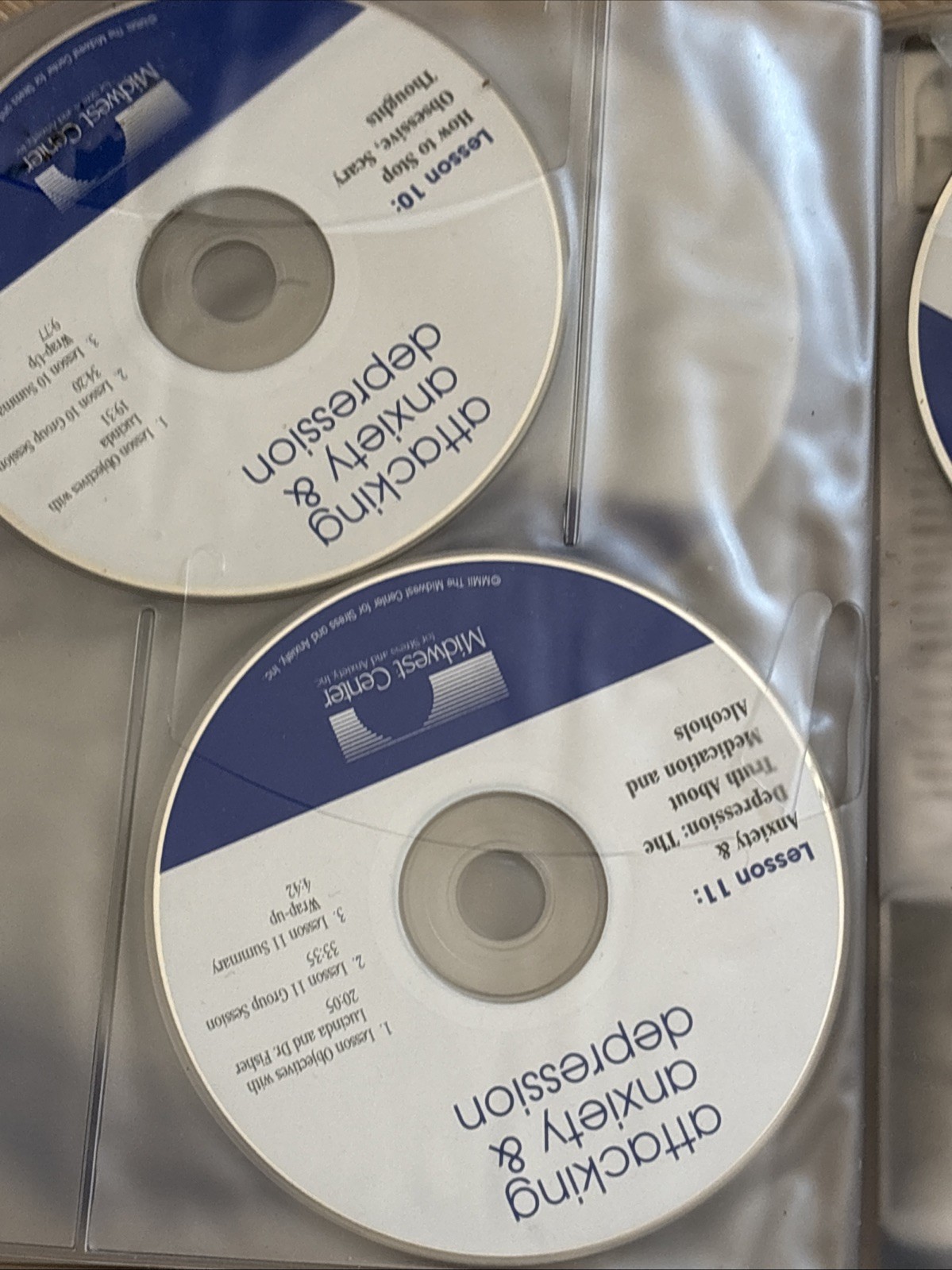 Attacking Anxiety and Depression Midwest Center Book & 16 Session CD Set