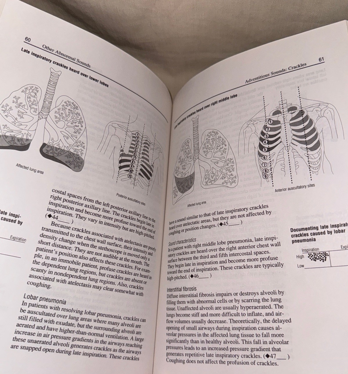 Normal & Abnormal Breath Sounds Springhouse 1990 Book and Audio Cassette